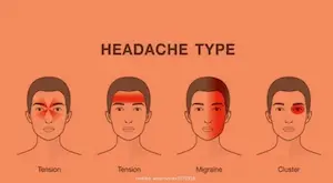 10 types of headaches